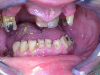 Dscn0791 ufjq5e - Eugenol