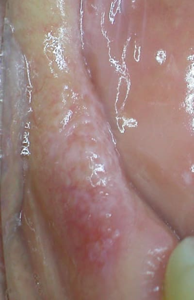 Dscn1047 msjijy - Eugenol