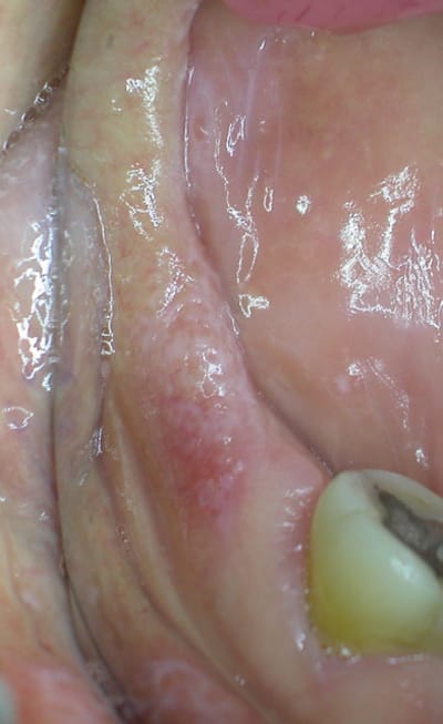 Dscn1048 mjsbsf - Eugenol