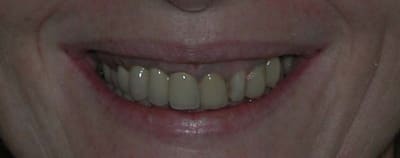 Dscn1327 copie crz9xk - Eugenol