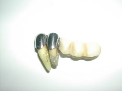 Dscn1383 bzyyuu - Eugenol