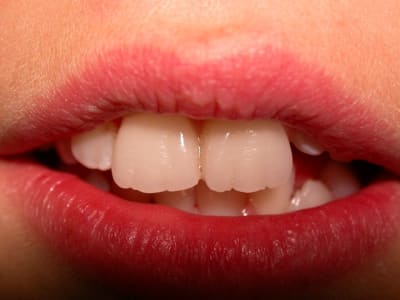 Dscn1391 hvxvad - Eugenol