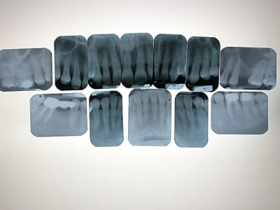 Dscn1695 ujsaqd - Eugenol