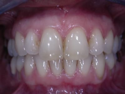Dscn1764 qa9to3 - Eugenol