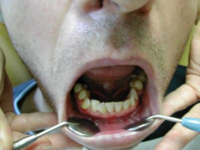 Dscn2057 wnpps6 - Eugenol