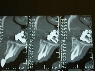 Dscn2560 hbqanh - Eugenol