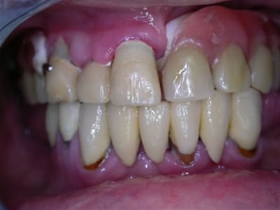 Dscn2598 pqlbuh - Eugenol