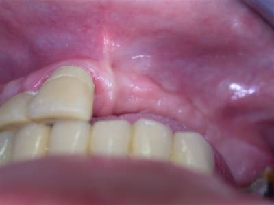 Dscn2606 lrjcmt - Eugenol