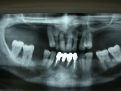 Dscn2704 mzbvno - Eugenol