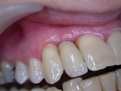 Dscn3234 kuuiqf - Eugenol