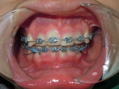 Dscn3969 a3z7oq - Eugenol