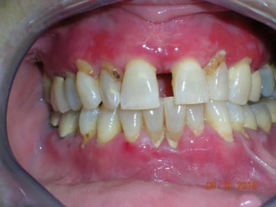 Dscn5176 pjsgc6 - Eugenol
