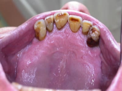 Dscn6842 pnkkjn - Eugenol