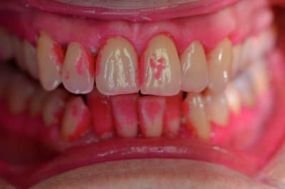 Dsc 0001 gdc8a2 - Eugenol