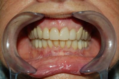 Dsc 0001 xnqwn8 - Eugenol