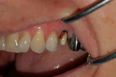 Dsc 0002 e7oomu - Eugenol