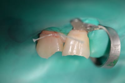 Dsc 0002 ua5rgb - Eugenol