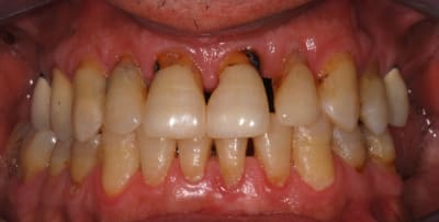 Dsc 0003 1 cnf9ix - Eugenol