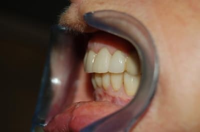 Dsc 0003 zzfm5p - Eugenol