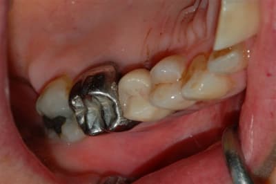 Dsc 0006 djqm87 - Eugenol