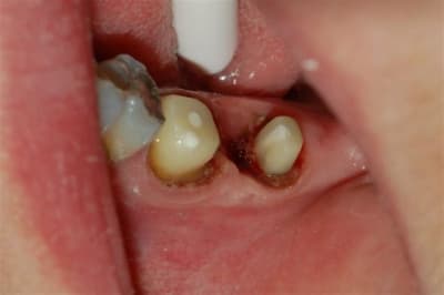 Dsc 0006 lyw2dd - Eugenol
