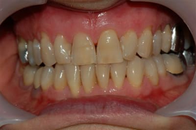 Dsc 0007 bddqbo - Eugenol