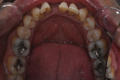 Dsc 0015 yfcwk4 - Eugenol