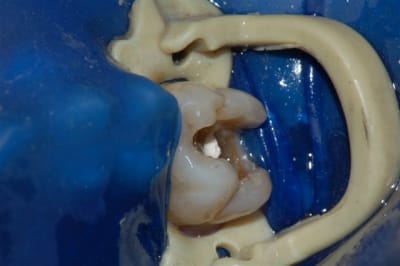 Dsc 0016 tei1h8 - Eugenol