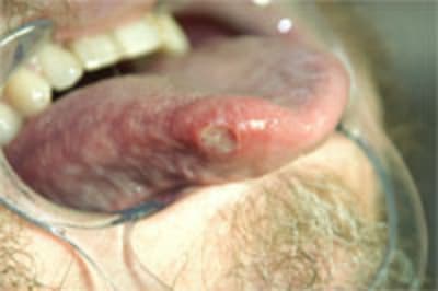 Dsc 0018 kfsbyu - Eugenol