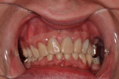 Dsc 0023 chgrrn - Eugenol