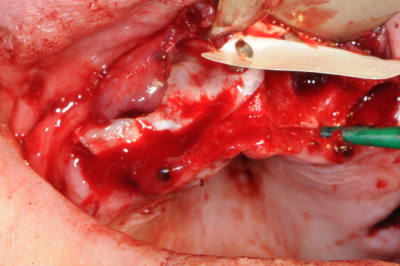 Dsc 0035 hw1win - Eugenol