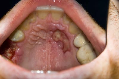 Dsc 0039 gyodgn - Eugenol