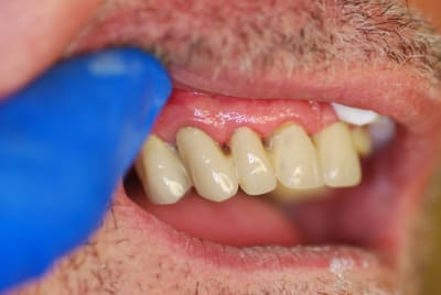 Dsc 0057 wqiycg - Eugenol