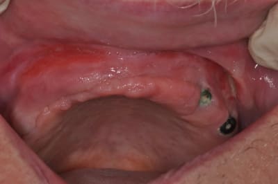 Dsc 0066 pm6kwb - Eugenol