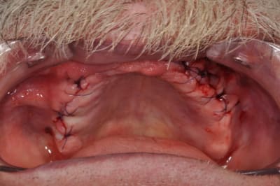 Dsc 0069 p272hp - Eugenol