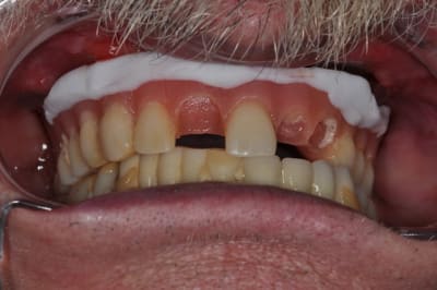 Dsc 0070 f4ow5y - Eugenol