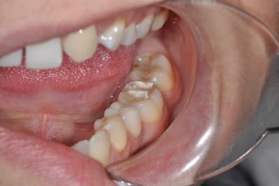 Dsc 0076 yxswd3 - Eugenol