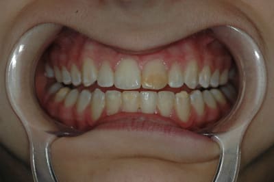 Dsc 0122 qu7egn - Eugenol