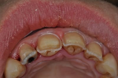 Dsc 0138 orbpz8 - Eugenol