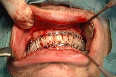 Dsc 0156 g9r26o - Eugenol