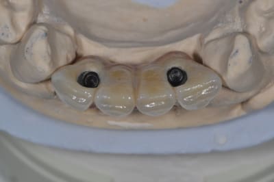 Dsc 0220 li32ga - Eugenol