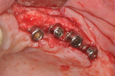 Dsc 0232 jyqc6d - Eugenol