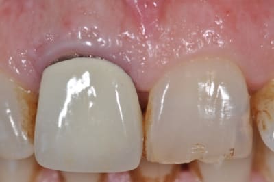 Dsc 0315 jfmulr - Eugenol