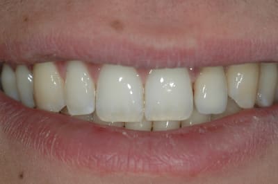 Dsc 0322 xxveb9 - Eugenol