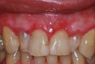 Dsc 0335 yhl5rn - Eugenol