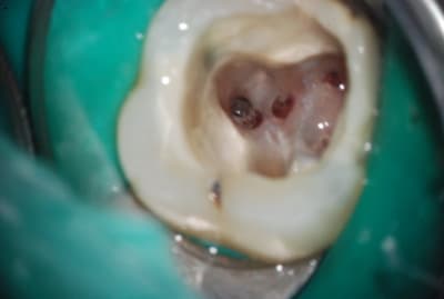 Dsc 0339 hqafyf - Eugenol