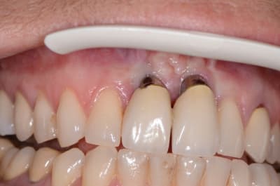 Dsc 0353 erm8z4 - Eugenol