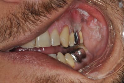 Dsc 0376 pljgkc - Eugenol