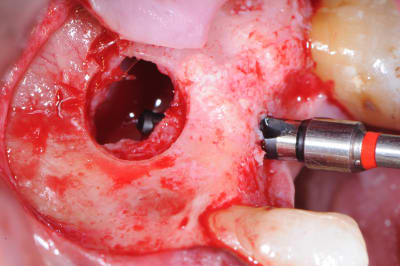 Dsc 0396 ueoq7y - Eugenol