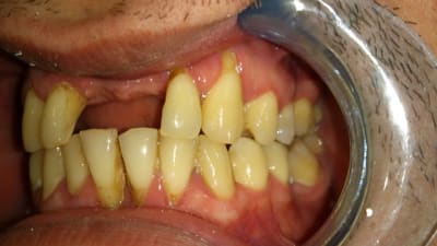 Dsc 0402 qeacam - Eugenol